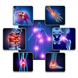 joint pain from uric acid